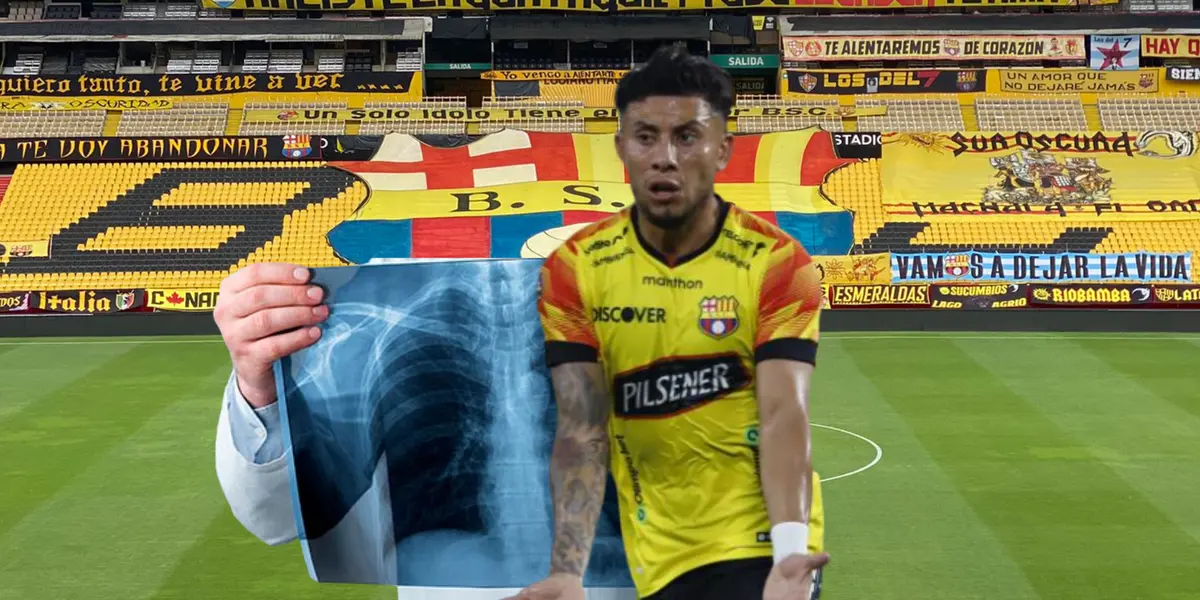 Y solo le sacaron amarilla, así quedó el hueso de Joao Rojas tras filtrase la radiografía